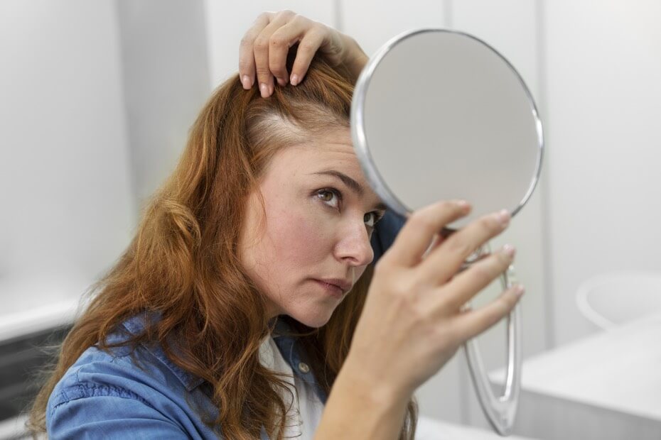 Foriu nos cuenta varios consejos y recomendaciones para prevenir la caída del cabello y lograr la salud capilar.